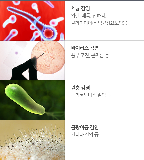 성병의 원인 및 종류